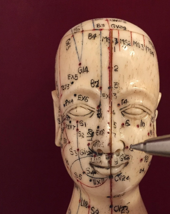 acupuncture therapy closeup